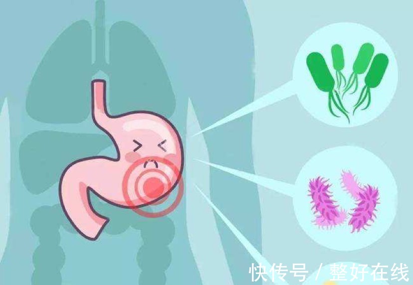 直肠|提醒:若出现以下不适症状,或是溃疡性结肠炎,4种方法可以缓解