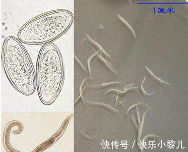 感染率|2岁女儿患上“蛲虫病”,得知原因后,宝妈直接气得带孩子回娘家