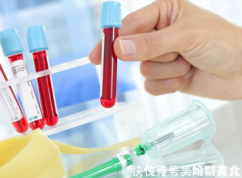 保护血管|104岁老人，年轻像50岁，长寿秘诀不是多锻炼，而是这3件事