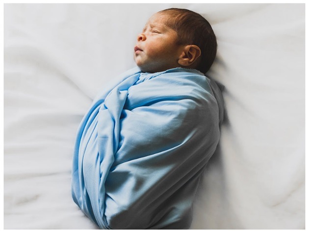 水肿|医院“黑脸宝宝”走红,妈妈忍住“没扔”,2月后完美逆袭