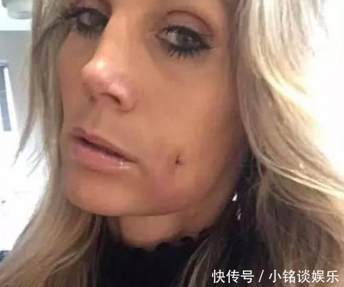 真的|整容界又现“黑科技”,酒窝也有人工的,网友:全身还有真的吗?