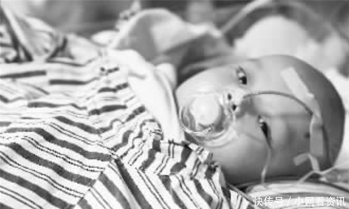 妹妹张珑|连体姐妹做分离手术时,共有器官给了姐姐,10年后妹妹怎么样了