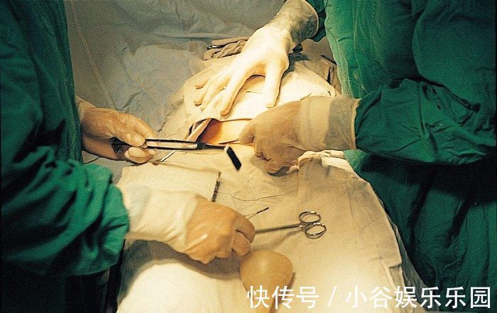 半麻|剖腹产的半麻和全麻,到底有什么区别?后者关系到胎儿健康