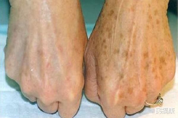 营养|哪些营养对老年人养生很重要？又该如何去补充？