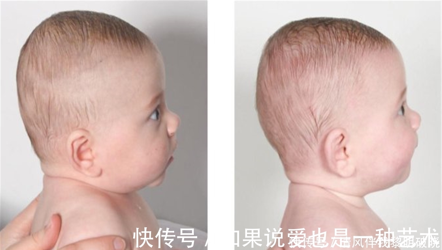 老苗|这种“头型”的宝宝,自带“高个”基因,未来长高潜力大