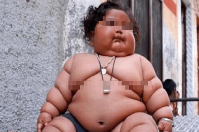 现状|7年了,那个8个月体重45斤,1天吃48顿饭的“巨婴”现状如何