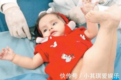 名人传|女童出生便患美人鱼症,喜欢呆在水里,用乐观打败缺陷