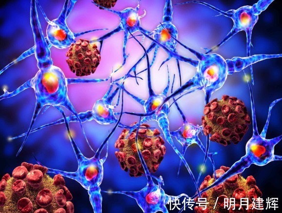 筛查|3大恶性肿瘤是癌症界的“伪装者”,身体一旦出现异常,及时筛查