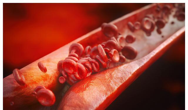 心血管疾病|不吃药，真能降血脂吗？医生确认了：能！但要认准这2种高血脂