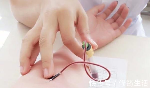 凌志军|07年查出肺癌晚期,现带癌生存17年,他分享了5条经验,值得借鉴