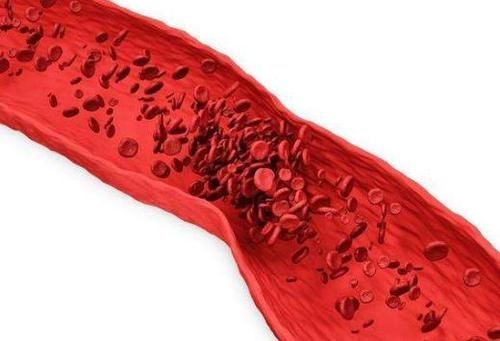 尽量|身体出现3种疼痛感,也许是“心梗”的提示,尽量别忽视