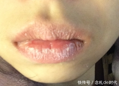 “肝”不好的人,嘴巴和眼睛可能会有几种变化,请不要忽视