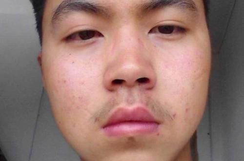 肾很好的男人,脸上无3个坏现象,若你1个都无,肾脏或许很健康