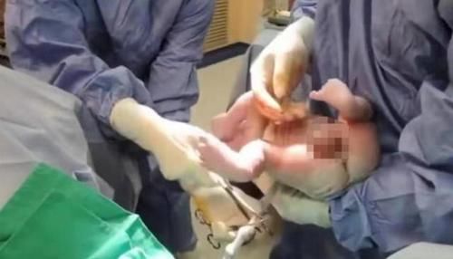 一组图带你了解:宝宝出生后,被医生抱走的神秘十分钟都经历了啥