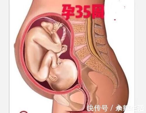优质蛋白|35周胎儿在肚子里总是鼓包包，肚子发硬，吸收有点难受正常吗？