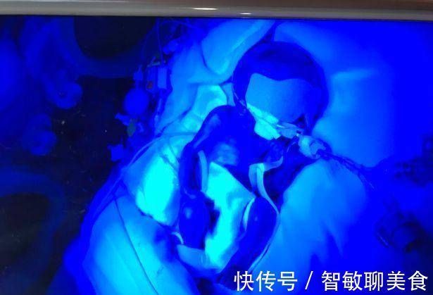 妇女|英国妇女在怀孕21周时生下一个孩子宝宝是透明的,可以看到体内的血液流动