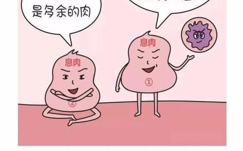 炎症性|肠道有息肉，这4种情况或发生恶变，要趁早切除，不能拖