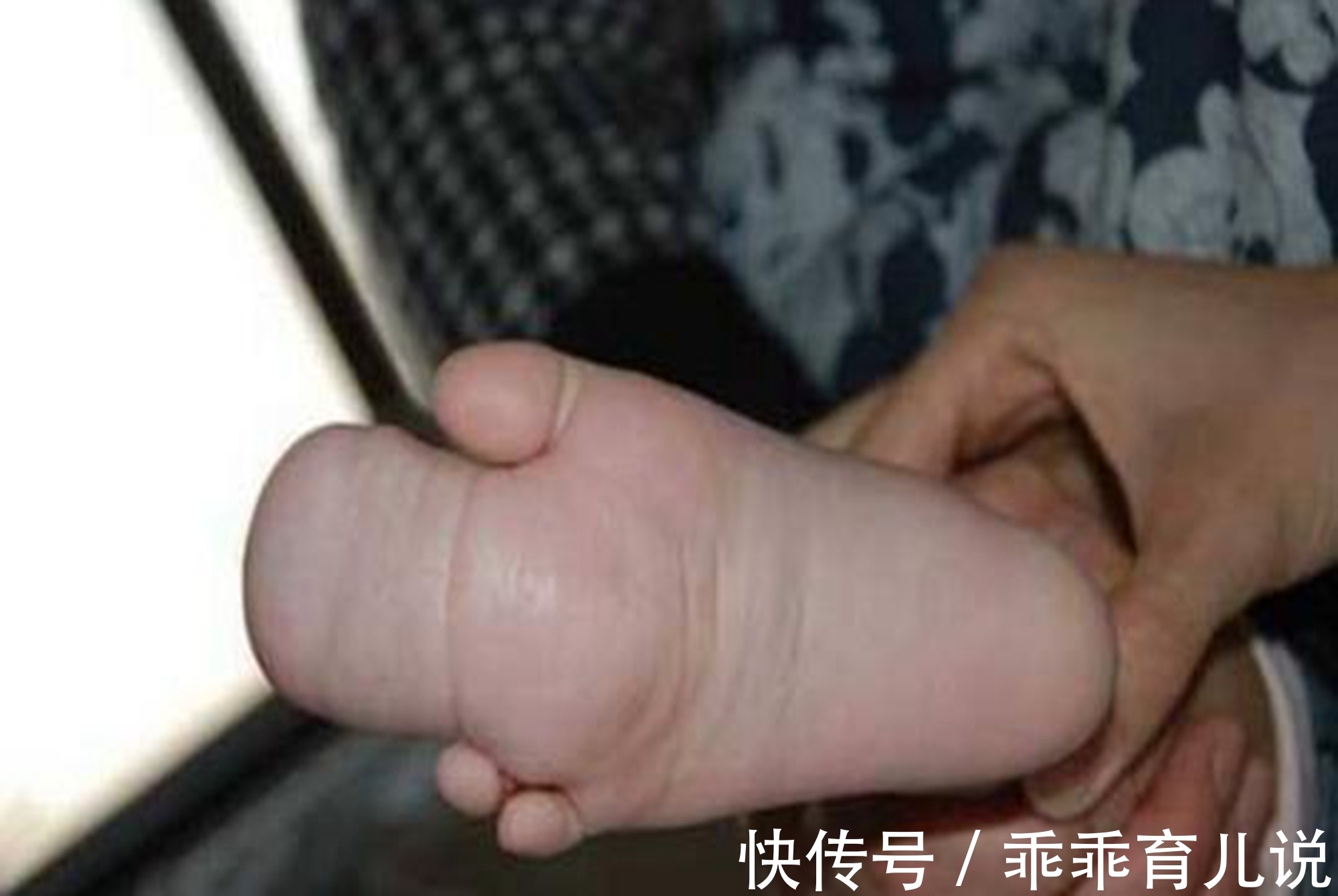 准妈妈们|畸形儿是怎么造成的？玩手机只是一个因素，孕妈们别在危险期犯傻