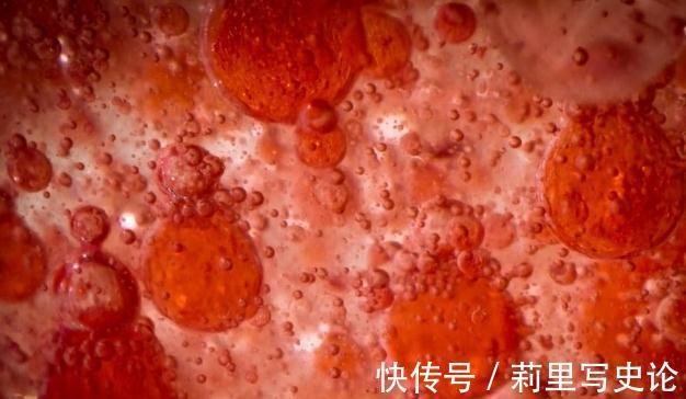 疫苗|“血脂疫苗”正式启用了,每年只需注射两次,什么人都可以打?