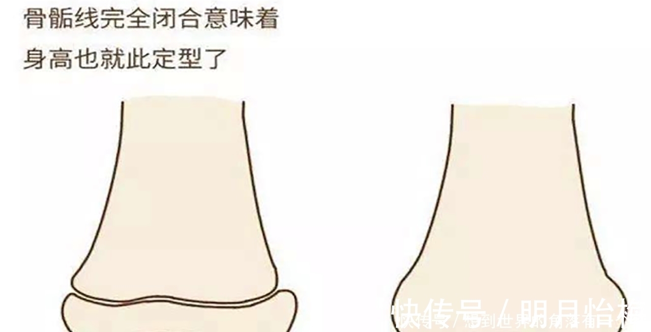 生长板|孩子长不高,全怪妈妈矮孩子骨骼发育的3个注意事项