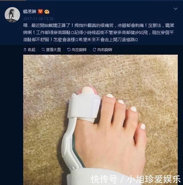 拇囊炎|穿高跟鞋的危害到底有多大?