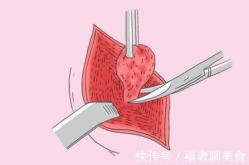 检查|肿瘤标志物检查，靠不靠谱？意义到底是什么？