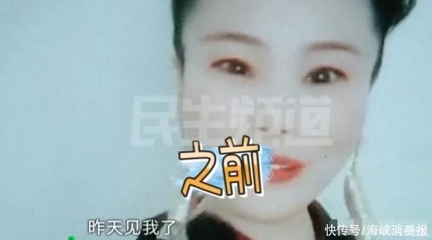 刘大姐|菜市场“万人迷”,整容翻车,花1万多做眼综合后崩溃了