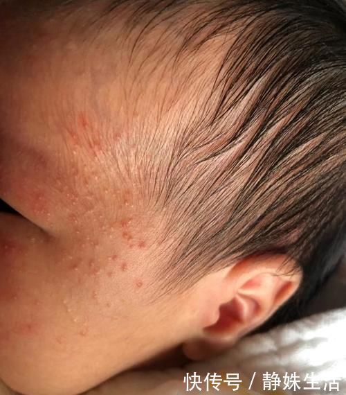 肉粥|1岁内娃，2种辅食易消化、益脾胃，孩子吃好不积食，养出好体质