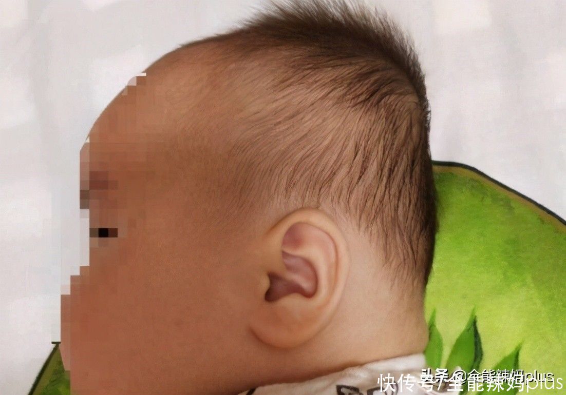 老人|“妈求求你,别给我睡扁头了”扁头有多毁娃?3张对比图告诉你