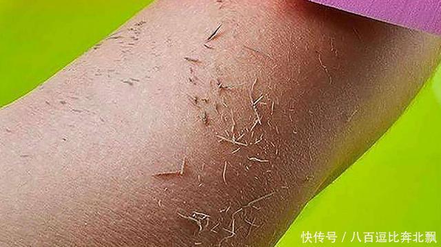 洗澡搓下的“黑泥”是什么?拿显微镜放大200倍,看完让人大开眼界