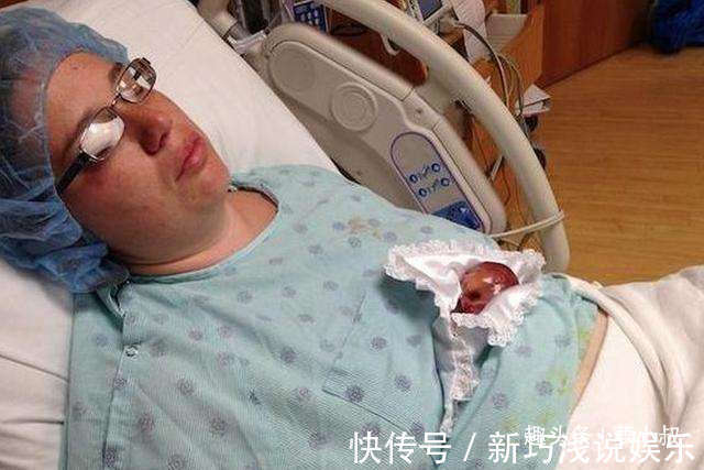 宝宝|14年前那个世上最小婴儿,看到如今颜值后,真令人羡慕!