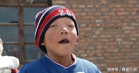 生出|避免生出痴呆儿,这3个检查必须要做!而且是免费的!