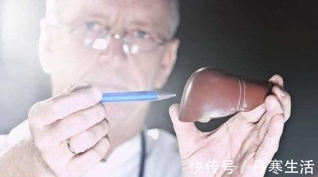 肝脏|肝病的“天敌”终于找到了, 早晚喝一杯, 排净肝毒, 肝越来越好