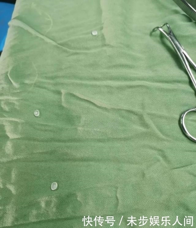 5岁男孩竟往耳朵里塞这个!全麻后才取出,医生紧急提醒