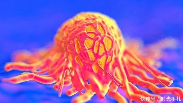  癌症自愈情况的发生，可能与4个方面有关