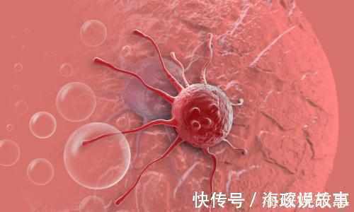 口腔癌|身体出现5个现象,说明这辈子患癌症的可能性小