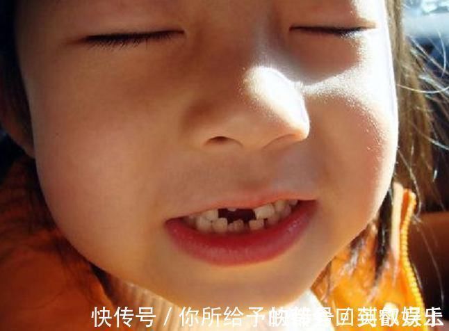 恒牙|6岁男娃长“双层牙”,老人的“坏习惯”害了娃,你家有这习惯吗