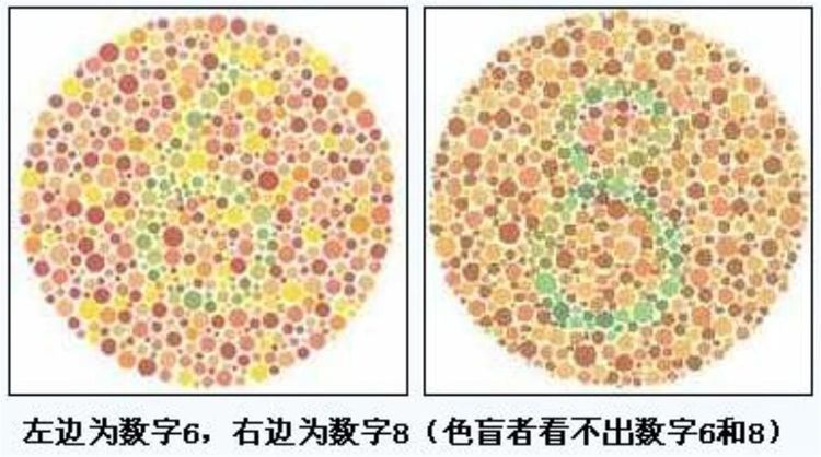 五官长|有一种遗传叫“隔代遗传”，爸爸妈妈幸运躲开了，孩子却中招了