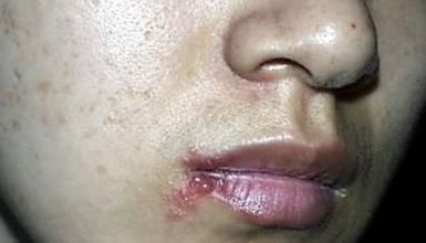 “嘴巴里”出现4种征兆,或是心脏“病”到晚期,赶快去医院检查