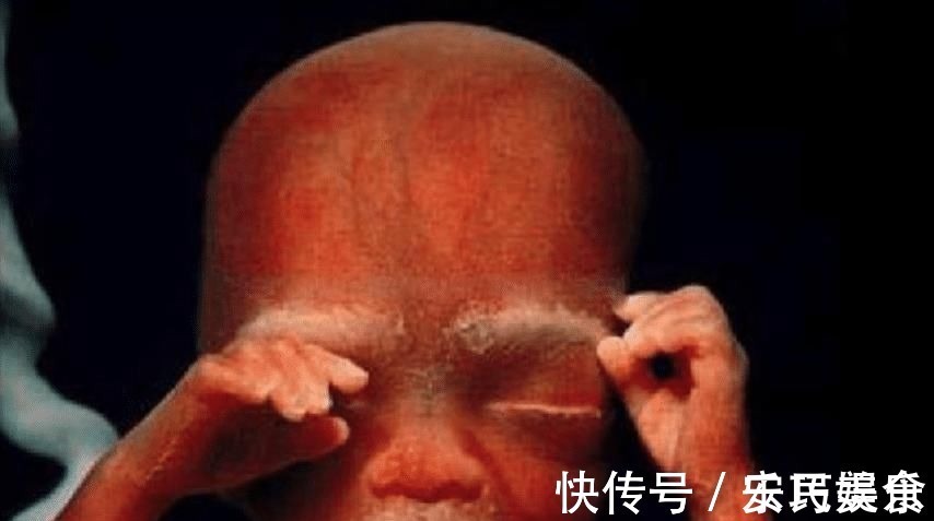 翻盘|产后“翻盘”了产检B超医生也忍不住打“暗语”,孕妈别会错意