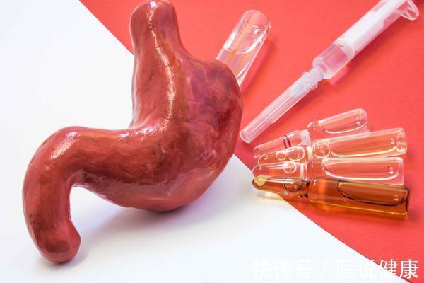 定期体检|从胃炎到胃癌,或经历4步骤,及时制止以免胃癌找上门