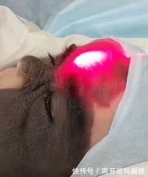 面具|7个月婴儿脸上因巨大黑色胎记爆红!像带着“蝙蝠侠”面具!