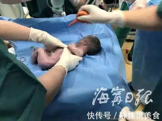 韦女士|孕妇产子情况危急,父亲打算放弃孩子前一句话让人泪崩