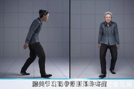 要点|全膝关节置换靠谱不?能用多长时间?祥和骨外科专家为你剖析