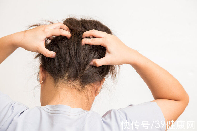 致癌 长期染发会致癌吗?多久染一次比较好?安全染发请记住4句话