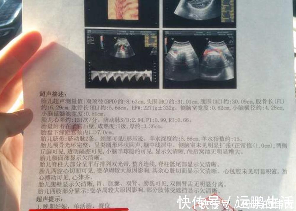 产妇|怀孕后多久,胎位就要固定了?这个孕周前,孕妈还能“调乾坤”