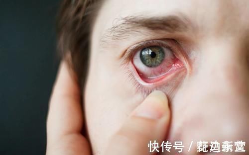 肝火过旺|肝火过旺的人，一般会有3种表现，若能注意两点，比吃啥都管用