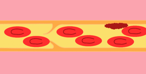 离世|年轻女记者崴脚12天后离世！她忽视的问题你可能每天都在犯