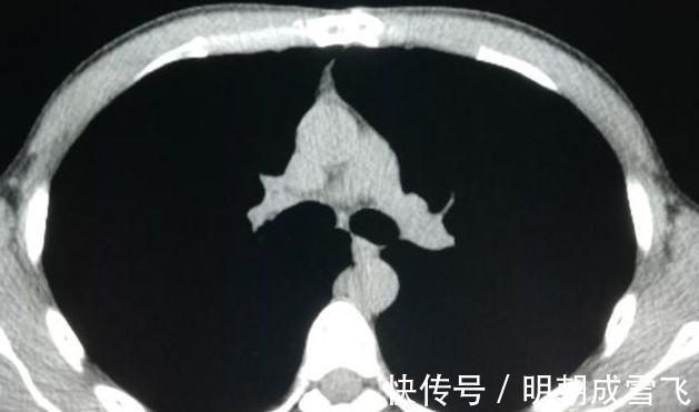 病人|癌症晚期病人差异这么大？有人可以5年以上，有人只有9天寿命？