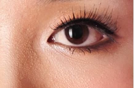 你的脸上有脂肪粒吗 不妨试试这几个方法, 轻松除掉它们!